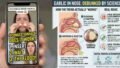 TikTok Garlic in Nose Trend: Does It Really Relieve Congestion or Cause Harm?