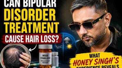 Can Bipolar Disorder Treatment Cause Hair Loss? What Honey Singh’s Experience Reveals