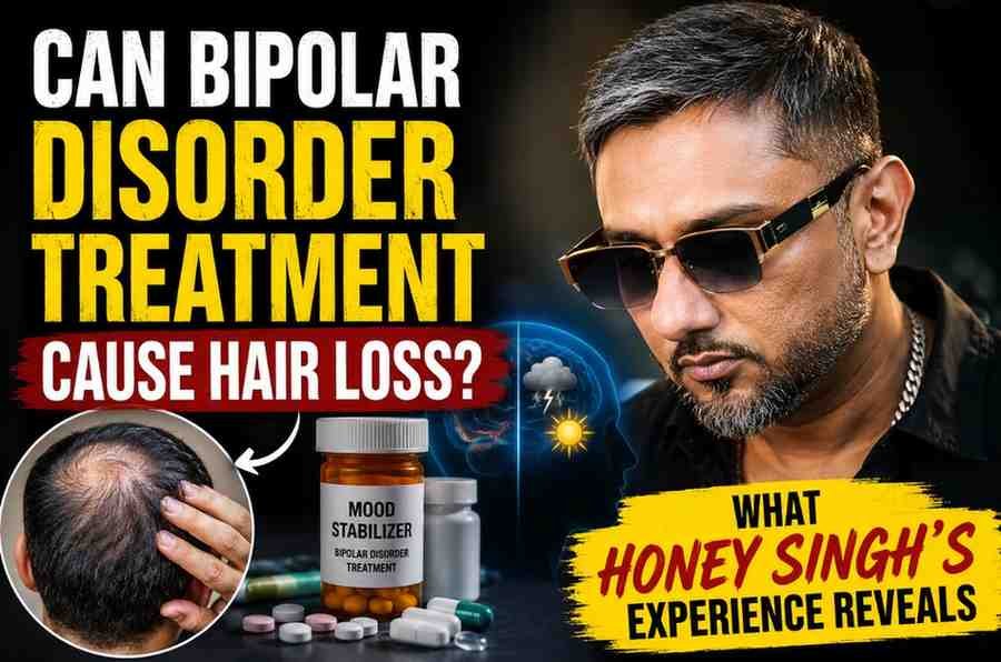 Can Bipolar Disorder Treatment Cause Hair Loss? What Honey Singh’s Experience Reveals