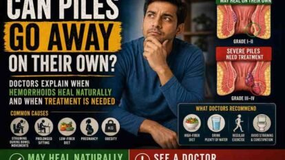 Can Piles Go Away on Their Own? Here’s What Doctors Say About Hemorrhoids and When Treatment Is Needed