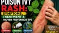Poison Ivy Rash: Symptoms, Treatment, and Prevention You Need to Know