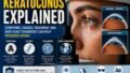 Keratoconus Explained: The Progressive Eye Disorder Among the Leading Causes of Vision Loss in Younger People