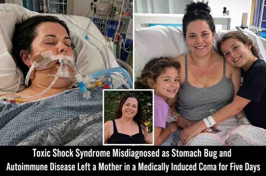 Toxic Shock Syndrome Misdiagnosed as Stomach Bug and Autoimmune Disease Left a Mother in a Medically Induced Coma for Five Days