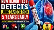 New Blood Test Detects Lung Cancer Risk 5 Years Early: Breakthrough in Early Detection