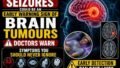Seizures Could Be an Early Warning Sign of Brain Tumour, Doctors Caution: Why Recognising Symptoms Early Can Save Lives