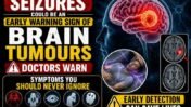 Seizures Could Be an Early Warning Sign of Brain Tumours, Doctors Warn: Symptoms You Should Never Ignore Seizures Could Be an Early Warning Sign of Brain Tumours, Doctors Warn: Symptoms You Should Never Ignore