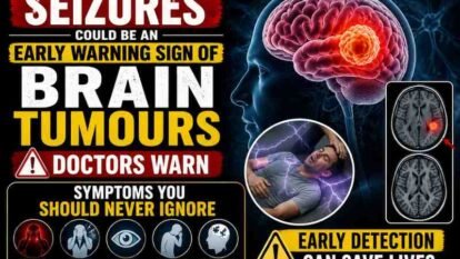Seizures Could Be an Early Warning Sign of Brain Tumours, Doctors Warn: Symptoms You Should Never Ignore Seizures Could Be an Early Warning Sign of Brain Tumours, Doctors Warn: Symptoms You Should Never Ignore