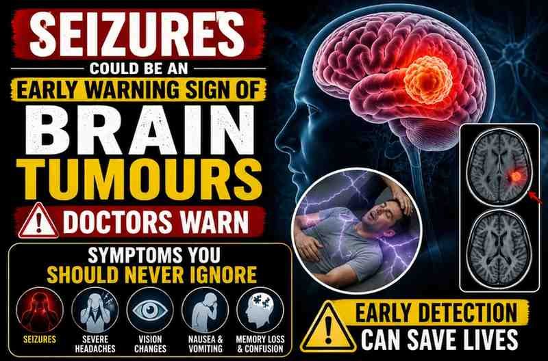 Seizures Could Be an Early Warning Sign of Brain Tumours, Doctors Warn: Symptoms You Should Never Ignore