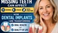 Missing Teeth Can Affect Chewing, Speech and Facial Structure: How Dental Implants Are Transforming Oral Health and Quality of Life