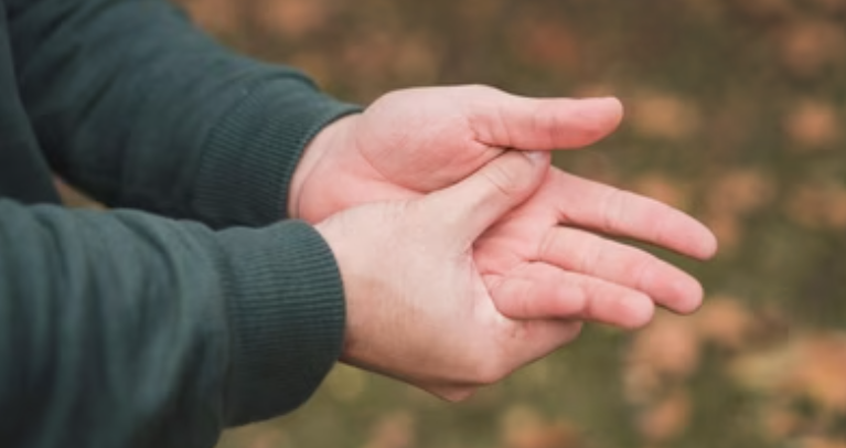Can Cracking Your Knuckles Damage Your Joints? Orthopaedic Surgeon Explains the Popping Sound, Arthritis Risk and Warning Signs