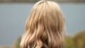 Severe Dandruff in Colour-Treated Hair: The Common Mistake an 18-Year-Old Made and What You Must Do Instead