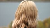 Severe Dandruff in Colour-Treated Hair: The Common Mistake an 18-Year-Old Made and What You Must Do Instead