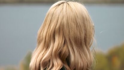 Severe Dandruff in Colour-Treated Hair: The Common Mistake an 18-Year-Old Made and What You Must Do Instead