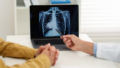 Persistent Cough and Lung Cancer Risk: Why Even Fit Non-Smokers Shouldn’t Ignore This Silent Warning
