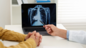 Persistent Cough and Lung Cancer Risk: Why Even Fit Non-Smokers Shouldn’t Ignore This Silent Warning