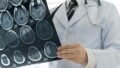 GLP-1 Weight-Loss Drugs May Lower Fracture Risk in Type 2 Diabetes: What the New Research Means for Bone Health