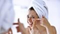 Can Stress Cause Acne? The Science Behind Stress, Hormones and Breakouts
