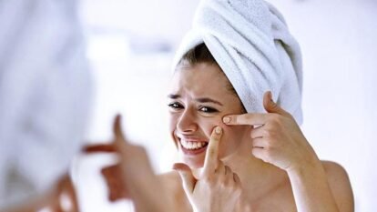 Can Stress Cause Acne? The Science Behind Stress, Hormones and Breakouts
