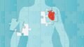 AI Heart Disease Prediction Tools Show Promise, But Why Aren’t They Ready for Clinical Use Yet?