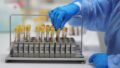 Kerala Blood Banks Face Calls for Advanced Screening to Detect HIV and Hepatitis Earlier