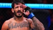 Lerryan Douglas Suffers Orbital Fracture After UFC Sacramento Knockout