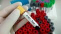 No New H1N1 Strain in India: ICMR Says Existing Flu Vaccines Are Sufficient