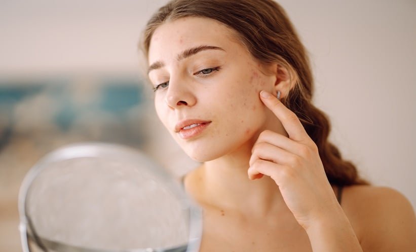 Formaldehyde Contact Allergy Remains a Global Concern, New Review Finds