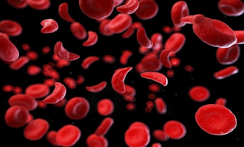 Daily Zinc Cuts Infections in Young Children With Sickle Cell Anaemia