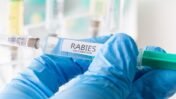 How Rabies Virus Infection Triggers Fatal Brain Immune Failure