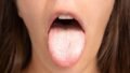Psoriasis Treatments Show Distinct Infection Risks, Nationwide Study Finds