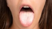 Psoriasis Treatments Show Distinct Infection Risks, Nationwide Study Finds