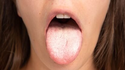 Psoriasis Treatments Show Distinct Infection Risks, Nationwide Study Finds