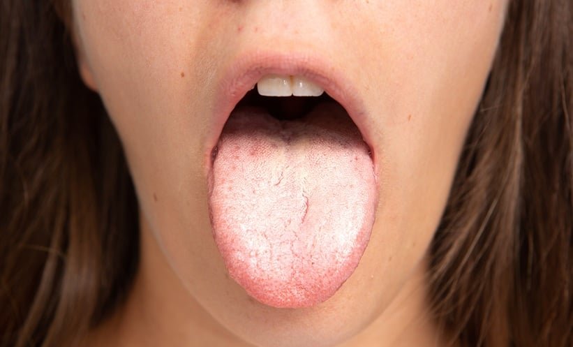 Psoriasis Treatments Show Distinct Infection Risks, Nationwide Study Finds