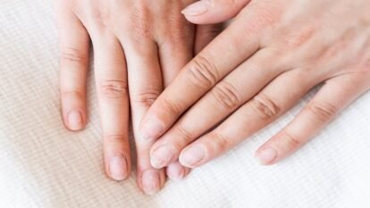 GLP-1 Nail Disorders More Common in Multinational Study: What EADV 2026 Research Found