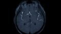 Integrated Cardiovascular Registry Tracks 80,478 Patients, Strengthening Real-World Heart and Stroke Research