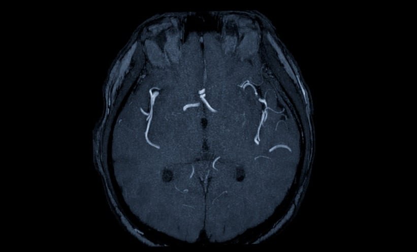 Integrated Cardiovascular Registry Tracks 80,478 Patients, Strengthening Real-World Heart and Stroke Research