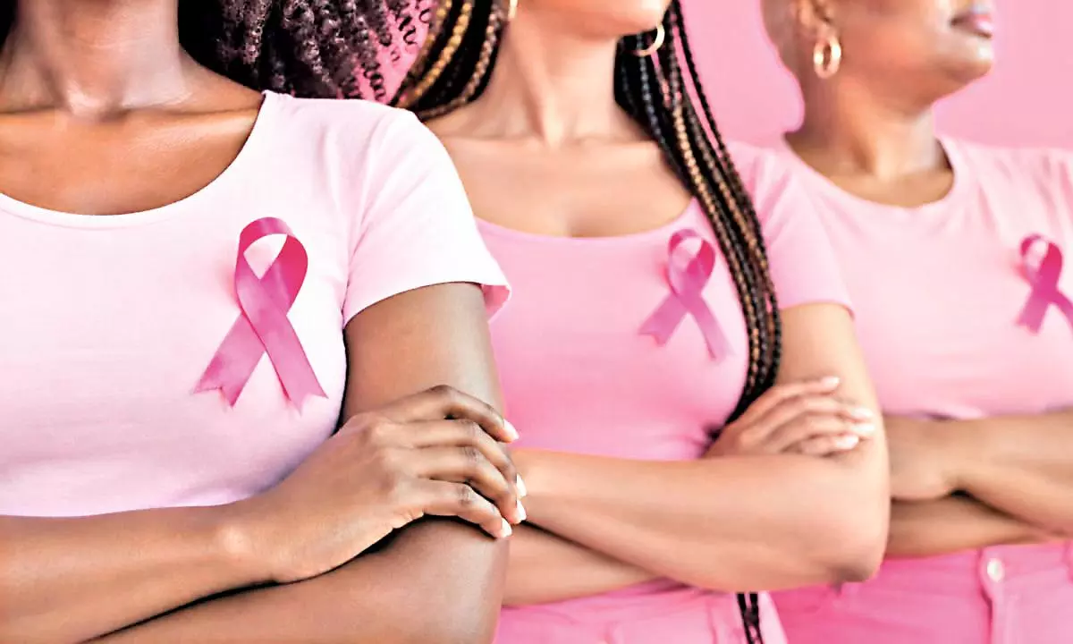 Bras, Stress, Deodorants and Breast Cancer: Oncologists Explain Which Myths to Stop Believing