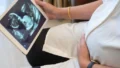 IVF Treatment: What Couples Should Know About Fertility