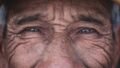 WHO: 2.2 Billion People Live With Vision Loss Worldwide