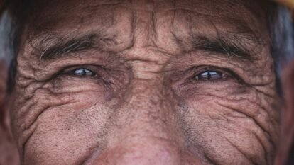 WHO: 2.2 Billion People Live With Vision Loss Worldwide WHO: 2.2 Billion People Live With Vision Loss Worldwide