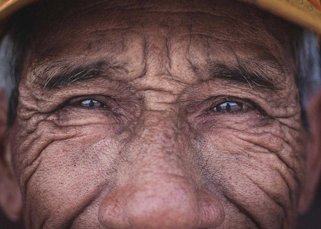 WHO: 2.2 Billion People Live With Vision Loss Worldwide